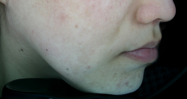 After Photo