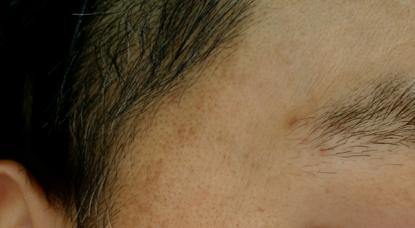 After Photo