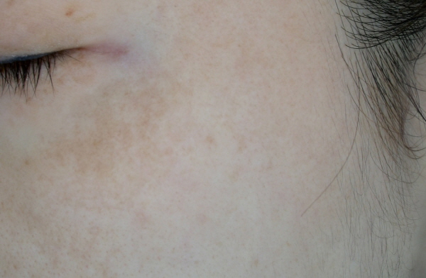 After Photo