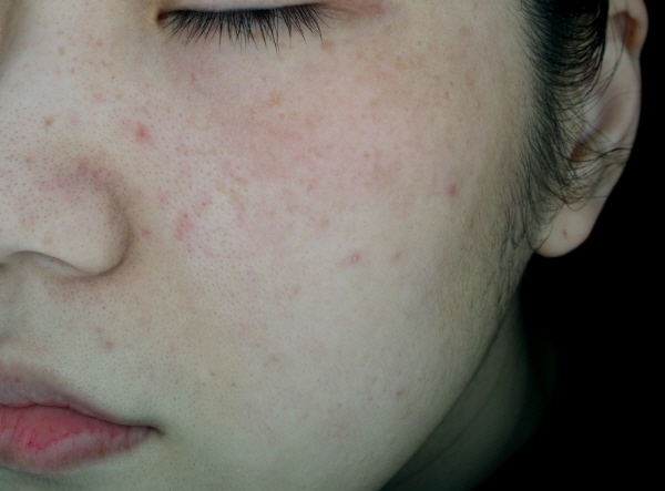 After Photo