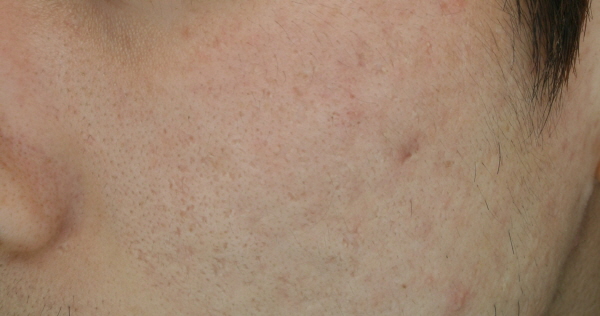 After Photo