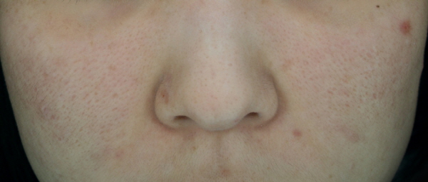 After Photo