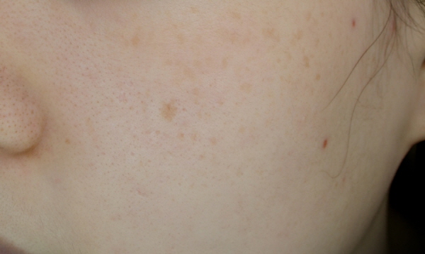 After Photo