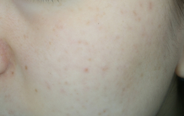 After Photo