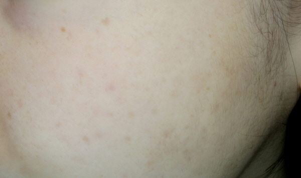 After Photo