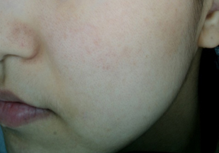 After Photo