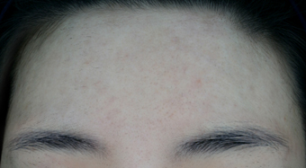 After Photo