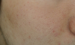 After Photo
